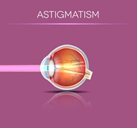 Astigmatism Diagram